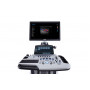 УЗИ аппарат SIUI Apogee 5800